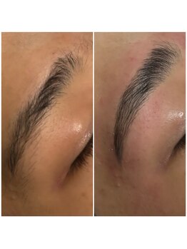 リザルト(Re'ZAlt)/HBL ブロウリフト