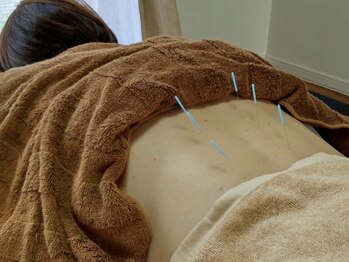 まるぴん堂の写真/日頃の疲れ解消に鍼灸+マッサ-ジ!鍼灸が少し苦手な方はマッサ-ジだけの施術も可◎お気軽にご相談ください☆