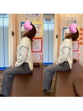 ヒデ整体院(Hide整体院)/猫背矯正骨盤矯正B/A肩こり腰痛