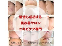 ペシュア(pecheA)