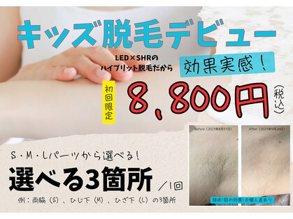 ムーア(muua)の写真