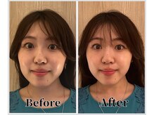 整体ラルース 中目黒(LALUZ)/30代 女性 頭蓋骨小顔矯正　変化