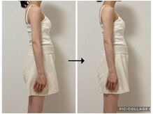 ソリ(soli)/before→after写真