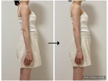 ソリ(soli)/before→after写真