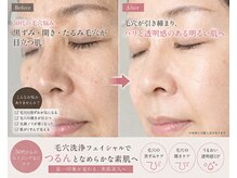 ルナ クレッシェンテ(Luna crescente)/大人の毛穴悩みもしっかりケア