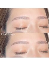 フレイズラピス(FRASE Lapis)/ハリウッドブロウリフト