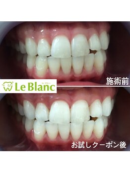 ルブラン 奈良店(Le Blanc)/今年のなつこそ!