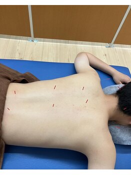 ながっち鍼灸治療院/鍼灸施術