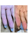 ハンドエッセンス1か月使用変化