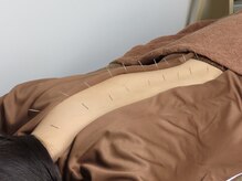 ジェネ鍼灸院の雰囲気（お悩みに合わせて最適な施術、根本改善へ。）
