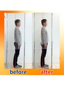 ストレッチヒーロー 広島中広店/巻き肩改善したい方へ