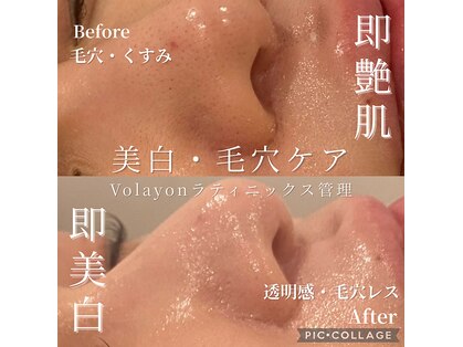 ポプリ(potpourri)の写真