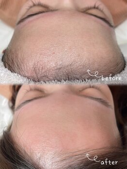 ブライズ(BRISE)/おでこwax