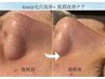 【平日11時～15時限定】5500円★毛穴ケア×肌質改善フェイシャル★60分