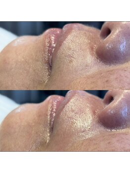 バイカラー(BY COLOR)/facial wax １パーツ