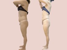 シェリートーキョー 成田店(Cherie Tokyo)/Before＆After /成田店