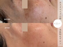 エイム(e.i.m)/50代：シミケア/シワケア