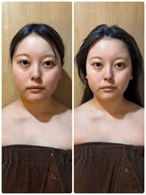 アグレア(Agrea)/頭蓋骨小顔矯正1回の施術♪