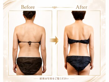 ヨサパーク クレヴィア(YOSA Park CREVIa)の写真/進化版よもぎ蒸し“ルルオン”で温活しながら全身のサイズダウン◎気になるむくみを解消して見た目が激変！