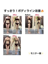 エステティック レイビス 秋田店(RAYVIS)/スッキリ！ボディライン改善！