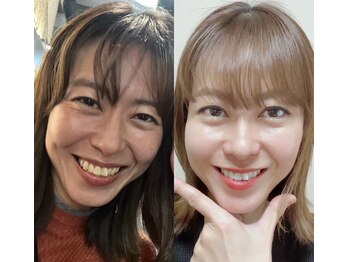 カドゥルエクラ(Cuddleclat)/ヒガ式表情筋ヨガ　1ヶ月の変化