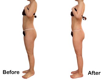 アロマテラピー 古香/話題のボディマシンでスッキリ