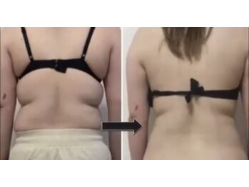 シャインミー(shine me)/最新痩身キャビ　インフィニティ