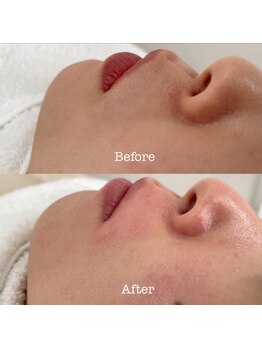 コロレ(colore)/フェイスワックス