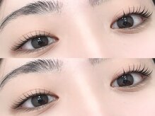 アマンズアイ(amans eye)