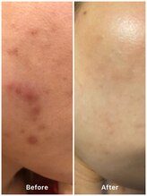 ミロク 伏見桃山店(miroku)/