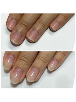 自爪育成/自爪育成クリア/美爪