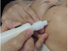 不動の人気♪シミケアは、色素をピンポイントで狙い撃ち！