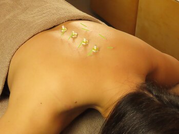 酵素札幌/鍼灸で肩こり/腰痛も改善◎