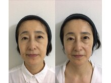 はいさい整骨院(haisai)/