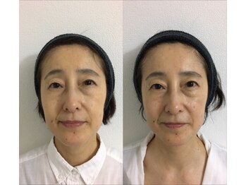 はいさい整骨院(haisai)/