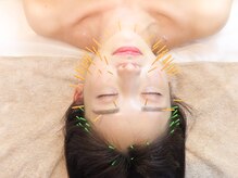 ハリックマ(HARICCUMA)の雰囲気（インスタで大人気美容鍼。コリをほぐしてリフトアップ！）