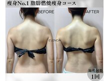 エレンシア(E'lencia)の雰囲気（１回で変化実感！【本気の痩身】機械×ハンドで脂肪にアプローチ）