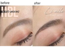 リエル(liaile)/ハリウッドブロウリフト