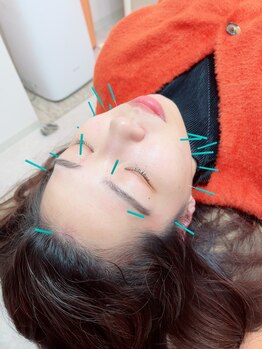 ヒーリングサロン アージュ(A-je)/★美顔鍼＋小顔矯正★