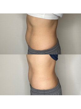 プルメリア(Plumeria)/マグニート☆