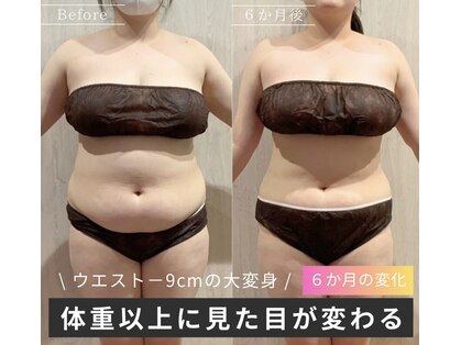 アイニティ ボディ トーニング 赤坂(INITY BODY TONING)の写真