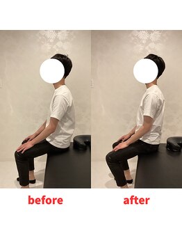 ナオル整体 福岡香椎院(NAORU整体)/20代男性施術事例【猫背】