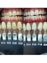 トウキョースワーズ 渋谷店(TOKYO SWRS)/#ホワイトニング #渋谷 #池袋