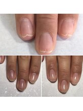 トレフル(Trefle)/セルフネイルのダメージも