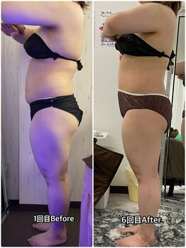 輝 らいと/ビフォーアフター(横)