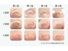 【フットネイル】巻き爪ケア　6050円→5500円！