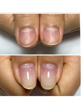 自爪育成/自爪育成クリア