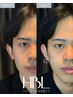 【モニタークーポン】HBL (眉ワックス込み)¥8,600→¥3,600