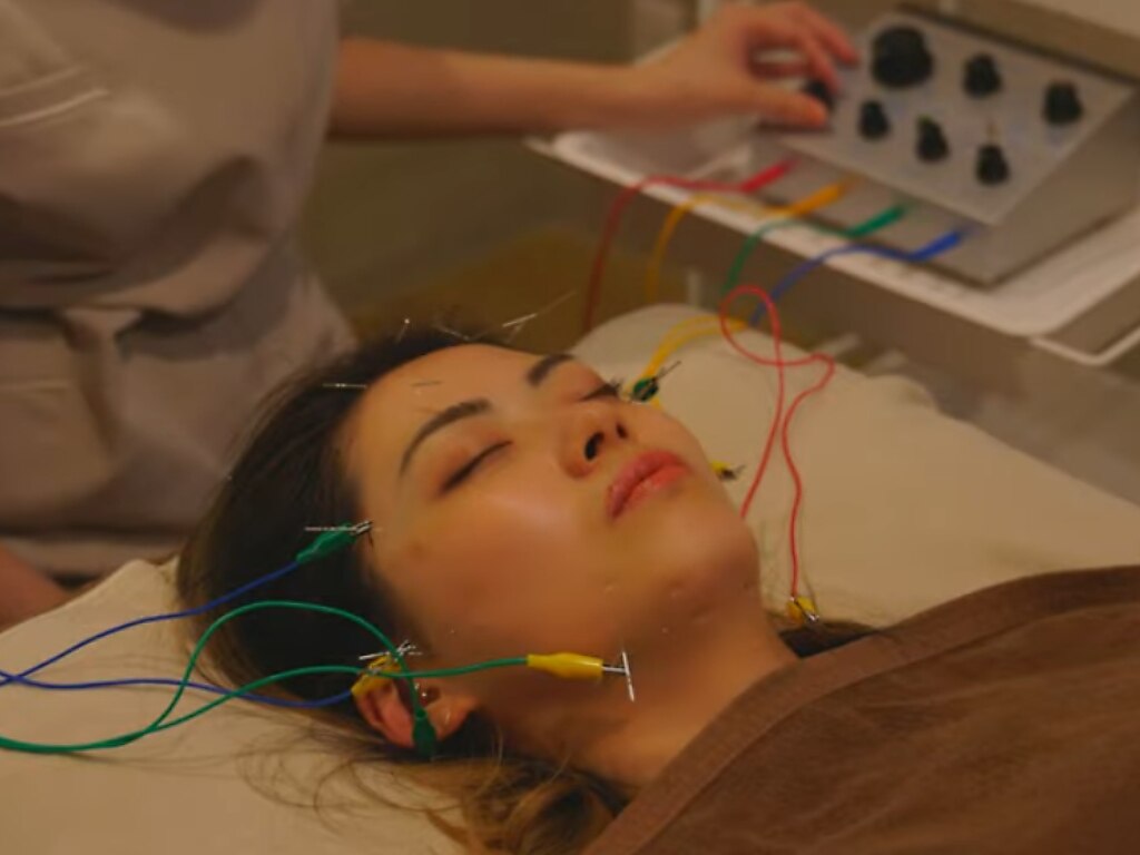 【フェイスラインのたるみ・口元もたつき◎】リフトアップ電流美容鍼