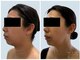 ミオ ダイカンヤマ 代官山(MIO DAIKANYAMA)の写真/本気で小顔を目指す方へ◇結果重視の肌管理
しわ/小顔/たるみ/しわ/造顔/リフトアップ/マッサージ/代官山